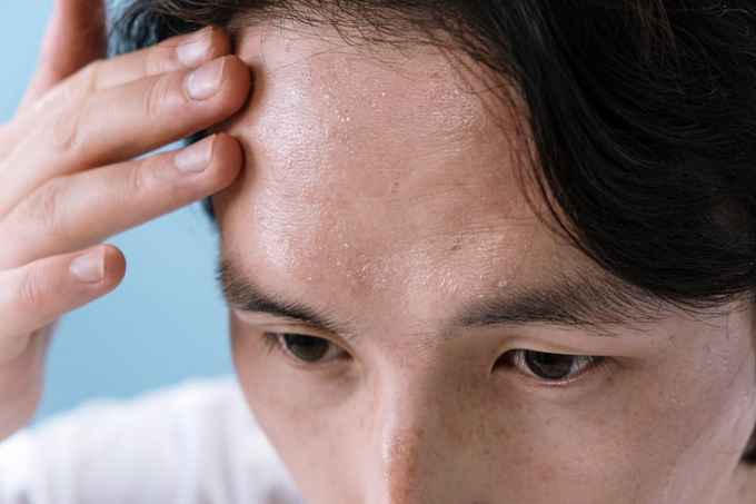 Big Forehead Concerns? Here’s What You Can Do About It